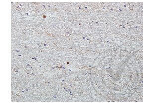 Immunohistochemistry validation image for anti-Wingless-Type MMTV Integration Site Family Member 2 (WNT2) (AA 221-320) antibody (ABIN762896)