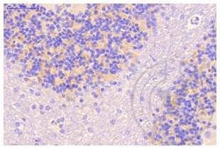Figure 1: Cerebellum stained with anti-Clathrin (brown) and counterstained in blue. 