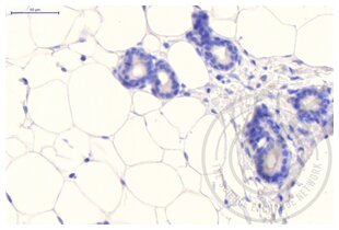 Figure 2: White adipose tissue stained with anti-Clathrin (brown) and counterstained in blue. 