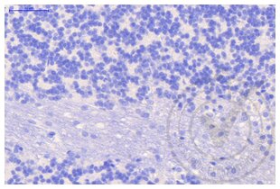 Immunohistochemistry validation image for anti-Clathrin (AA 4-171) antibody (ABIN968006) (Clathrin antibody  (AA 4-171))