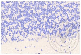 Immunohistochemistry validation image for anti-Clathrin (AA 4-171) antibody (ABIN968006) (Clathrin antibody  (AA 4-171))
