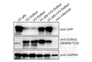 Immunoblot of DsRed or EGFP expressing human fibroblast lysates using ABIN967350. Cells were infected with EGFP-expressing virus (V1-gfp), DsRed-expressing viruses (V2-/V3-DsRed), or co-infected as indicated. The lane on the far right contains a sample from non-infected cells.