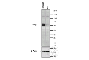 Figure 1: Western blot analysis of U251-MG and PC3 cell line extracts using Tumor Protein P53 (TP53) antibody (Catalog number ABIN967416, Lot number 2335876). TP53 is present in the positive control sample (U251-MG) and absent from the negative control sample (PC3). The arrowhead indicates the expected position of TP53 (predicted MW ~53kDa). 32 micrograms of total protein lysates from each sample were loaded into each lane. Upper panel: scanned image of the TP53 antibody probed with the U251-MG and PC3 extracts in lanes 1 and 2 respectively. Lower panel: scanned image of the loading control (beta-actin). 
