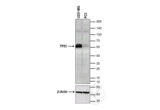 anti-Tumor Protein P53 (TP53) (full length) antibody