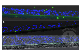 Staining of rhinovirus in a human 3D respiratory tissue model infected with HRV-14 using ABIN5688681 and an AF488-conjugated secondary antibody (A). In comparison, the same tissue model without HRV-14 infection (B) or stained using the secondary antibody only (C). Stained rhinovirus appears as a green signal, DAPI counterstain in blue. 