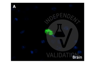 Immunohistochemistry validation image for anti-Amyloid beta (A4) Precursor Protein (APP) (C-Term) antibody (ABIN2855011)