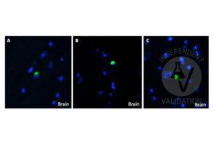 beta Amyloid anticorps  (C-Term)