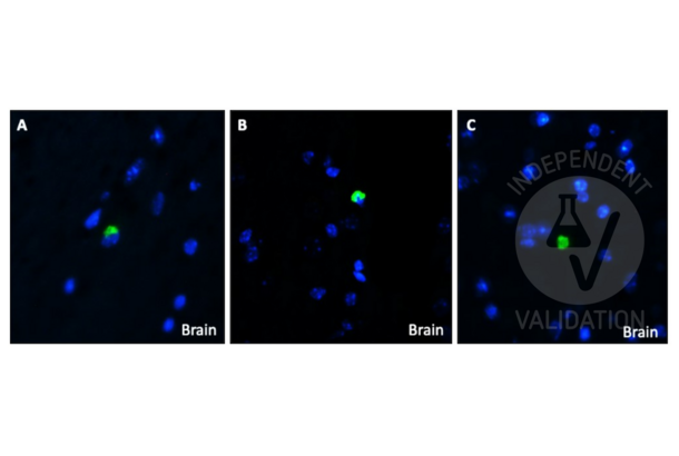 beta Amyloid anticorps  (C-Term)