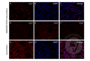 Androgen Receptor antibody  (N-Term)