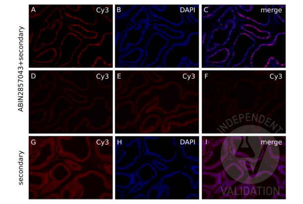 Androgen Receptor antibody  (N-Term)