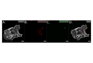 Staining of a human macrophage after infection with Borrelia burgdorferi B31. A. shows labeling of a protein associated to plasma membranes and endomembranes. B. and C. depict labeling of Borrelia burgdorferi B31 inside and outside of the cell respectively with ABIN236885. Panel D. is an overlay of all three channels.