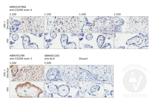 CD200 anticorps  (Internal Region)