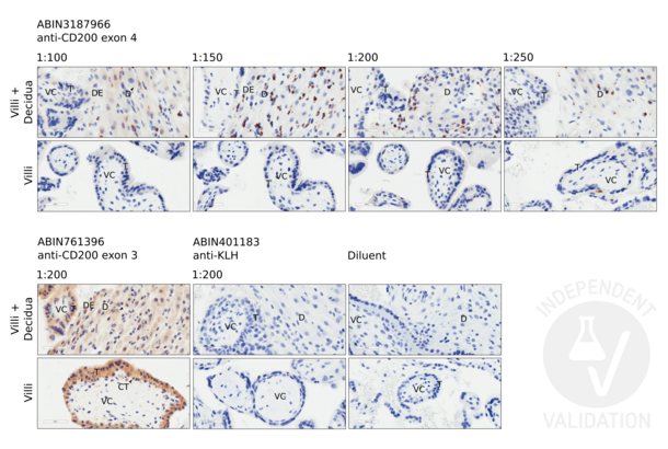 CD200 anticorps  (Internal Region)