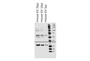 20µl, 10µl, and 5µl of 1:5 diluted extracellular vesicle (EV)/exosome solution from C57BL/6 mice were separated on an 4-20% polyacrylamid gel under denaturing conditions. CD63 (upper portion of the image) and CD9 (lower portion of the image) bands were revealed as described in the protocol section.