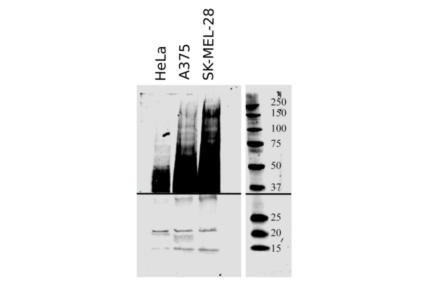 CD63 抗体  (AA 120-175)