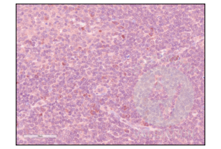 Immunohistochemistry validation image for anti-CD84 (CD84) (Internal Region) antibody (ABIN3187786)