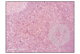 Immunohistochemistry validation image for anti-CD84 (CD84) (Internal Region) antibody (ABIN3187786)