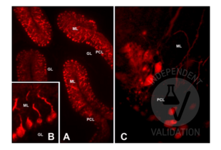 CALB1 anticorps