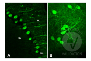 Immunohistochemistry validation image for anti-Calbindin (CALB1) antibody (ABIN3018777)