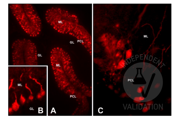 CALB1 anticorps