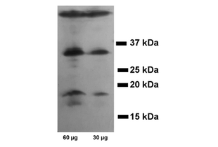 P5 mouse cerebellum, 30 seconds exposition. 60µg (left) and 30µg (right) protein loaded. The inactive procaspase 3 is visible at a MW of approximately 32kDa. The p17 subunit of active Casp3 is revealed between the 15kDa and 20kDa bands of the MW marker.