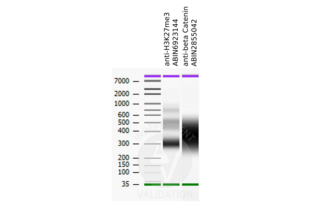 Bioanalyzer profiles comparing fragment size distributions between reads obtained from CUT&RUN using an anti-H3K27me3 CUT&RUN Positive Control antibody ABIN6923144 and anti-beta Catenin ABIN2855042 after library preparation.