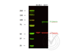 anti-Catenin, beta (CATNB) (C-Term) antibody