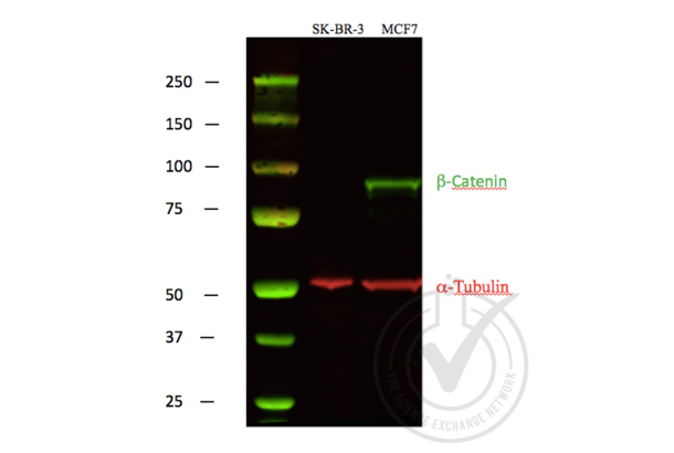 beta Catenin Antikörper  (C-Term)