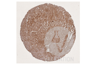 Immunohistochemistry validation image for anti-Collagen, Type I (COL1) antibody (ABIN5596819)