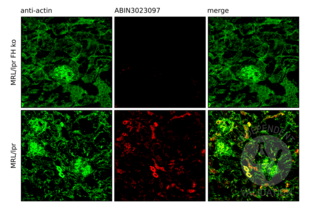 Complement Factor H antibody (AA 20-270)