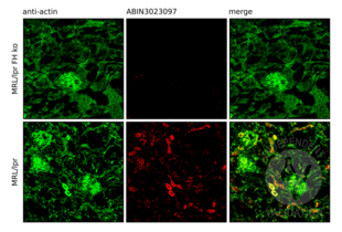 Complement Factor H antibody  (AA 20-270)