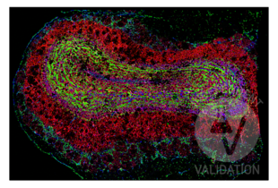 Multiplex Immunohistochemistry validation image for anti-Cortactin (CTTN) (N-Term) antibody (ABIN2854674)