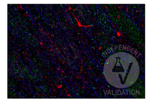 Multiplex Immunohistochemistry validation image for anti-Cortactin (CTTN) (N-Term) antibody (ABIN2854674)