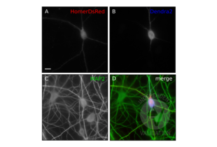 Immunocytochemistry validation image for anti-Dendra 2 antibody (ABIN361314)