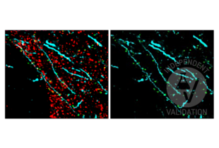 Multiplex Immunohistochemistry validation image for anti-Discs, Large Homolog 4 (Drosophila) (DLG4) antibody (ABIN361694)