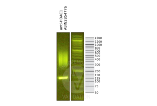 Library profiles comparing fragment size distributions on an E-Gel EX 2% agarose gel (Thermo Fisher). Fragments obtained from CUT&RUN using anti-HDAC1 antibody ABIN2854776 after library preparation, compared to the E-Gel Sizing DNA Ladder (Thermo Fisher). 