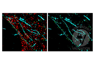 FFPE normal human cortex tissue section labeled with anti-MAP2 antibody ABIN125739 (cyan; bound to fluorophore ATTO 550) after EDTA antigen retrieval. DLG4 and Synapsin were labeled with anti-DLG4 antibody ABIN361694 (green; bound to fluorophore ATTO 550) and anti-SYN1 antibody ABIN5542390 (red; bound to fluorophore AF488).