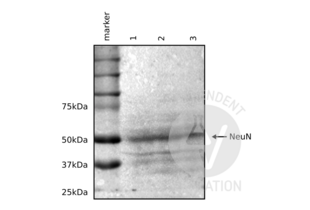 Western blot using ABIN5542704 to reveal CALB1 (28 kDa) in extracts from two different mouse brains (1 and 2) and in cerebellum extracts (3).