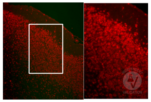 Neu-N immunoreactive neuronal nuclei in the mouse cerebral cortex. The area in the rectangle is shown at higher magnification in the right panel. Original magnification 20x – insert 40x.