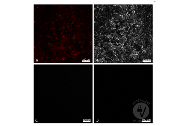 RFP antibody