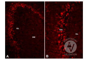 Reelin expression in the postnatal day 5 mouse cerebellum. EGL = external granular layer of the cerebellar cortex; IGL = internal granular layer of the cerebellar cortex;PCL/ML = Purkinje cell/molecular layers of the cerebellar cortex; WM = white matter. Staining is mainly observed in the processes of the pre-migratory granule cells. Original magnifications: A=10x; B= 20x
