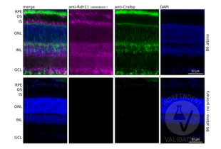Retinal sections from the wild-type (B6 albino) mice immunostained with anti-RDH11 antibody ABIN966957. DAPI staining shows localization of the inner (INL) and outer (ONL) nuclear layer of the mouse retina. Cralbp (Rlbp1) co-staining was used to visualize RPE and Müller glia cells in the retina. Presence of specific signal in the RPE cell layer confirms specific immunoreactivity. 