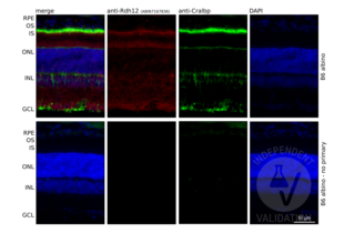 RDH12 antibody  (AA 1-316)