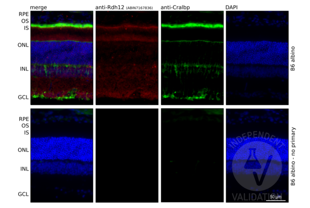 RDH12 antibody  (AA 1-316)