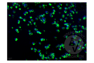 Immunofluorescence of SARS-CoV-2 infection in FFPE cell pellets from in vitro cultured human lung cells infected with SARS-CoV-2. Anti-SARS-CoV-2 Spike S1 antibody RBD antibody ABIN6952546 is visualized with PhenoCycler reporters in green and DAPI-stained chromatin in blue.