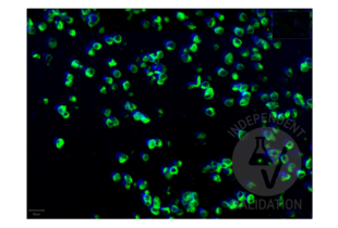 Immunofluorescence of SARS-CoV-2 infection in FFPE cell pellets from in vitro cultured human lung cells infected with SARS-CoV-2. Anti-SARS-CoV-2 Spike S1 antibody RBD antibody ABIN6952546 is visualized with PhenoCycler reporters in green and DAPI-stained chromatin in blue.