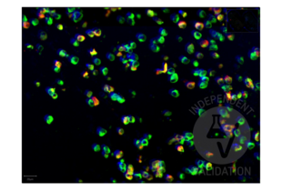 Multiplex Immunohistochemistry validation image for anti-SARS-CoV-2 Spike S1 (AA 318-510), (RBD) antibody (ABIN6952546) (Recombinant SARS-CoV-2 Spike S1 antibody  (RBD))