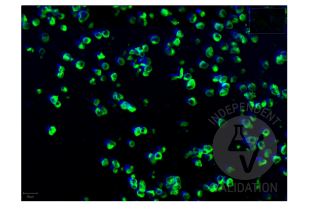 Recombinant SARS-CoV-2 Spike S1 antibody  (RBD)