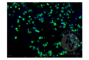 Recombinant SARS-CoV-2 Spike S1 antibody  (RBD)