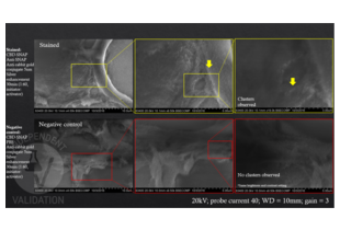 Electron Microscopy validation image for anti-SNAP Tag antibody (ABIN1573927) (SNAP Tag antibody)
